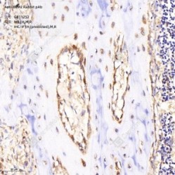 Anti-BMP2 Rabbit pAb - 100 µL