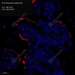 Anti-Osteocalcin Rabbit pAb - 100 µL