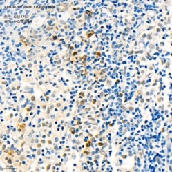 Anti-RUNX1/AML1 Rabbit pAb - 100 µL