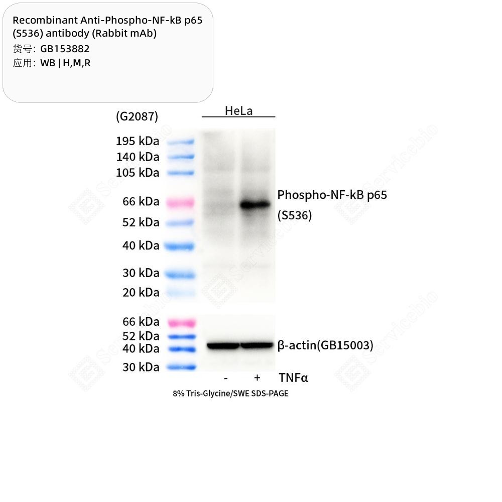 Recombinant Anti-Phospho-NF-kB p65 (S536) antibody (Rabbit mAb) - 50 µL