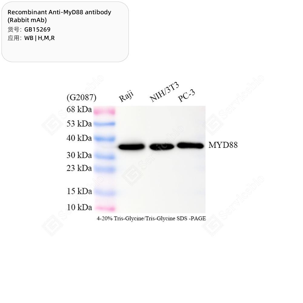 Recombinant Anti-MyD88 antibody (Rabbit mAb) - 50 µL