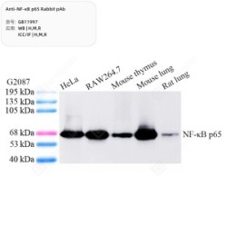 Anti-NF-κB p65 Rabbit pAb - 50 µL