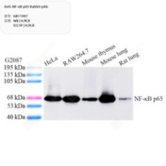 Anti-NF-κB p65 Rabbit pAb -...
