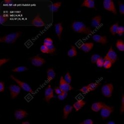 Anti-NF-κB p65 Rabbit pAb - 100 µL
