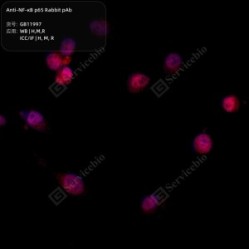 Anti-NF-κB p65 Rabbit pAb - 100 µL
