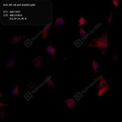 Anti-NF-κB p65 Rabbit pAb - 100 µL