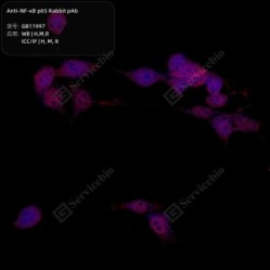 Anti-NF-κB p65 Rabbit pAb - 100 µL
