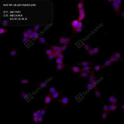 Anti-NF-κB p65 Rabbit pAb - 100 µL