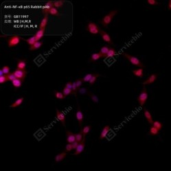 Anti-NF-κB p65 Rabbit pAb - 100 µL