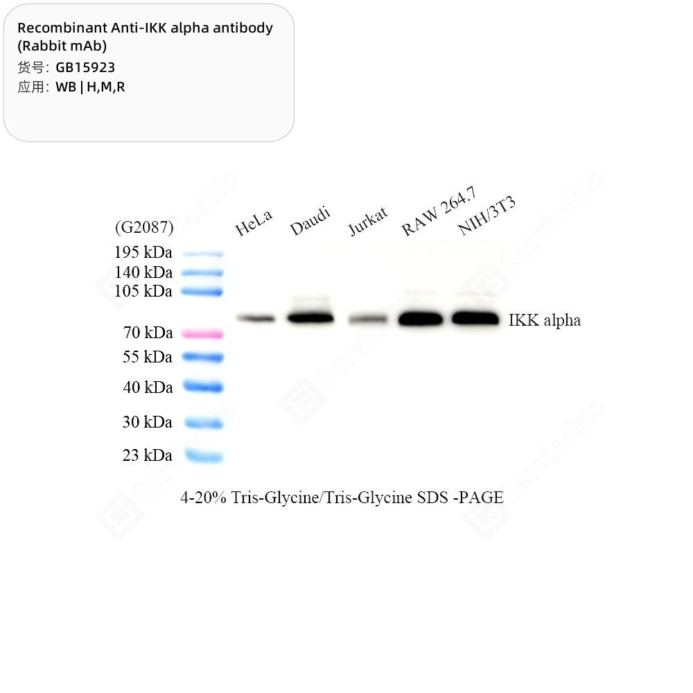 Recombinant Anti-IKK alpha antibody (Rabbit mAb) - 100 µL