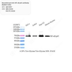 Recombinant Anti-NF-κB p65...