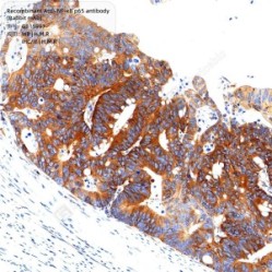 Recombinant Anti-NF-κB p65 antibody (Rabbit mAb) - 100 µL