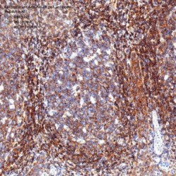 Recombinant Anti-NF-κB p65 antibody (Rabbit mAb) - 100 µL