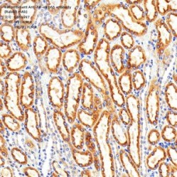 Recombinant Anti-NF-κB p65 antibody (Rabbit mAb) - 100 µL