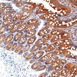 Recombinant Anti-NF-κB p65 antibody (Rabbit mAb) - 100 µL