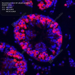 Recombinant Anti-NF-κB p65 antibody (Rabbit mAb) - 100 µL