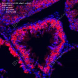 Recombinant Anti-NF-κB p65 antibody (Rabbit mAb) - 100 µL
