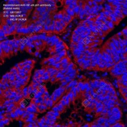 Recombinant Anti-NF-κB p65 antibody (Rabbit mAb) - 100 µL