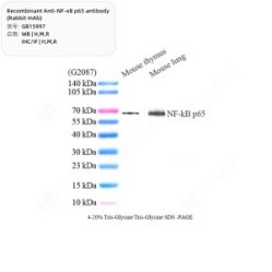 Recombinant Anti-NF-κB p65 antibody (Rabbit mAb) - 50 µL