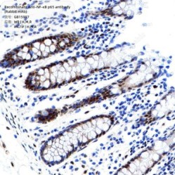 Recombinant Anti-NF-κB p65 antibody (Rabbit mAb) - 50 µL