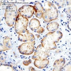 Recombinant Anti-NF-κB p65 antibody (Rabbit mAb) - 50 µL