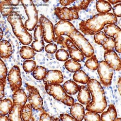 Recombinant Anti-NF-κB p65 antibody (Rabbit mAb) - 50 µL