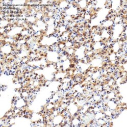 Recombinant Anti-NF-κB p65 antibody (Rabbit mAb) - 50 µL