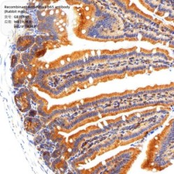 Recombinant Anti-NF-κB p65 antibody (Rabbit mAb) - 50 µL