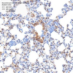 Recombinant Anti-NF-κB p65 antibody (Rabbit mAb) - 50 µL