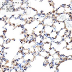 Recombinant Anti-NF-κB p65 antibody (Rabbit mAb) - 50 µL