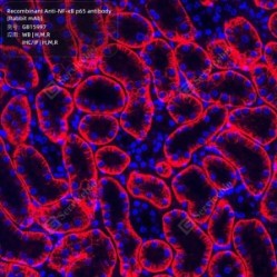 Recombinant Anti-NF-κB p65 antibody (Rabbit mAb) - 50 µL