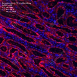 Recombinant Anti-NF-κB p65 antibody (Rabbit mAb) - 50 µL