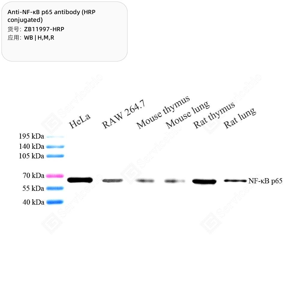 Anti-NF-κB p65 antibody (HRP conjugated) - 50 µL
