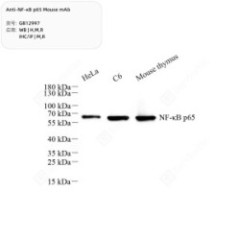 Anti-NF-κB p65 Mouse mAb -...