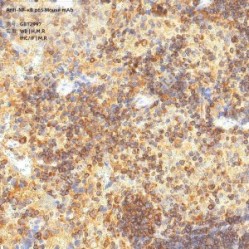 Anti-NF-κB p65 Mouse mAb - 50 µL