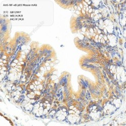 Anti-NF-κB p65 Mouse mAb - 50 µL