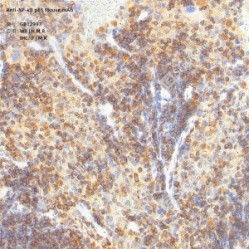 Anti-NF-κB p65 Mouse mAb - 50 µL