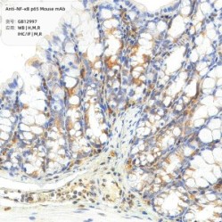 Anti-NF-κB p65 Mouse mAb - 50 µL