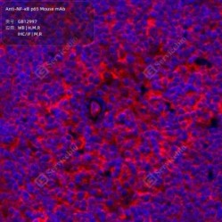 Anti-NF-κB p65 Mouse mAb - 50 µL