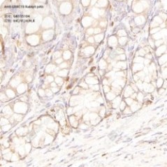 Anti-LRRC19 Rabbit pAb - 50 µL