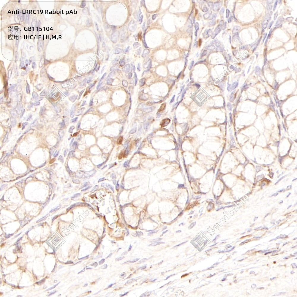 Anti-LRRC19 Rabbit pAb - 50 µL