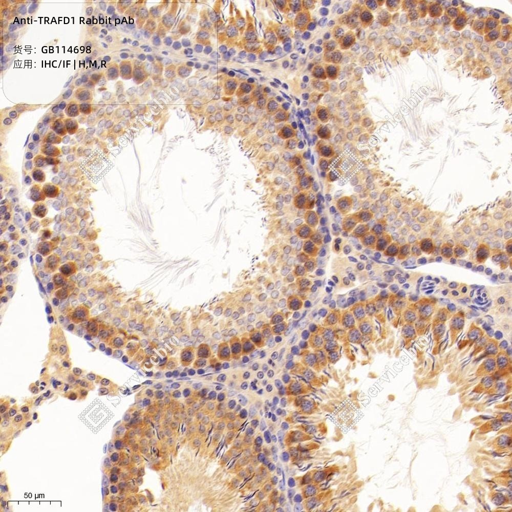 Anti-TRAFD1 Rabbit pAb - 50 µL
