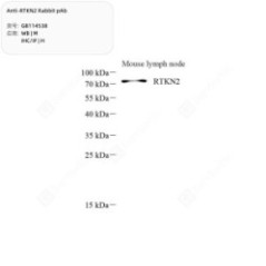 Anti-RTKN2 Rabbit pAb - 50 µL