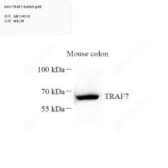 Anti-TRAF7 Rabbit pAb - 50 µL