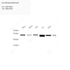 Anti-IKB beta Rabbit pAb -...