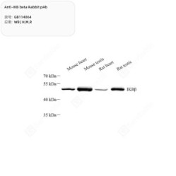 Anti-IKB beta Rabbit pAb - 50 µL