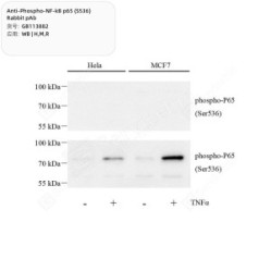 Anti-Phospho-NF-kB p65 (S536) Rabbit pAb - 50 µL