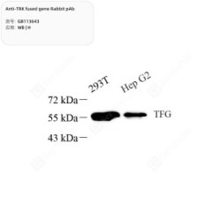 Anti-TRK fused gene Rabbit pAb - 50 µL