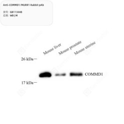 Anti-COMMD1/MURR1 Rabbit pAb - 50 µL