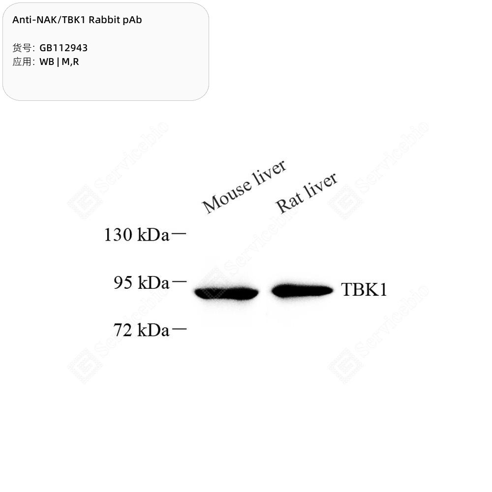 Anti-NAK/TBK1 Rabbit pAb - 50 µL